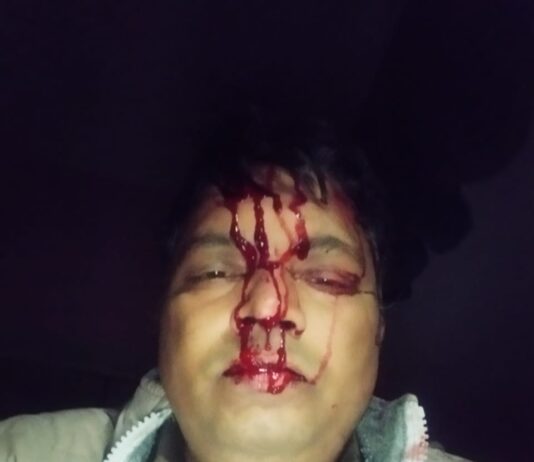 स्टे के बावजूद निर्माण पुलिस टीम पर हमला