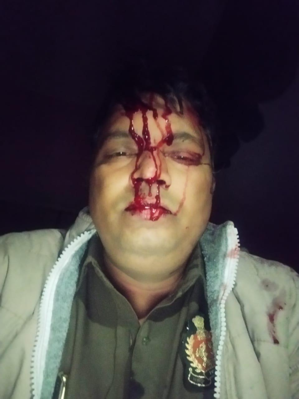 Photo of स्टे के बावजूद निर्माण पुलिस टीम पर हमला