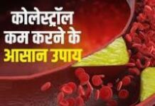 कोलेस्ट्रॉल कम करने के घरेलू उपाय क्या हैं..? कोलेस्ट्रॉल कम करने के घरेलू उपाय क्या हैं..?