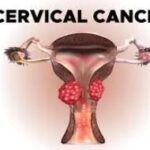 सर्वाइकल कैंसर के खिलाफ टीकाकरण अभियान सर्वाइकल कैंसर के खिलाफ टीकाकरण अभियान