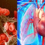 गाढ़ा खून बन सकता है जानलेवा! समय रहते पहचानें संकेत गाढ़ा खून बन सकता है जानलेवा! समय रहते पहचानें संकेत