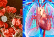 गाढ़ा खून बन सकता है जानलेवा! समय रहते पहचानें संकेत गाढ़ा खून बन सकता है जानलेवा! समय रहते पहचानें संकेत