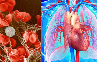 गाढ़ा खून बन सकता है जानलेवा! समय रहते पहचानें संकेत गाढ़ा खून बन सकता है जानलेवा! समय रहते पहचानें संकेत