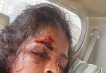 दबंगों का कहर: युवती को पीटा,पुलिस की कार्रवाई पर उठे सवाल दबंगों का कहर: युवती को पीटा,पुलिस की कार्रवाई पर उठे सवाल