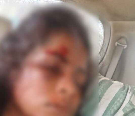 दबंगों का कहर: युवती को पीटा,पुलिस की कार्रवाई पर उठे सवाल दबंगों का कहर: युवती को पीटा,पुलिस की कार्रवाई पर उठे सवाल