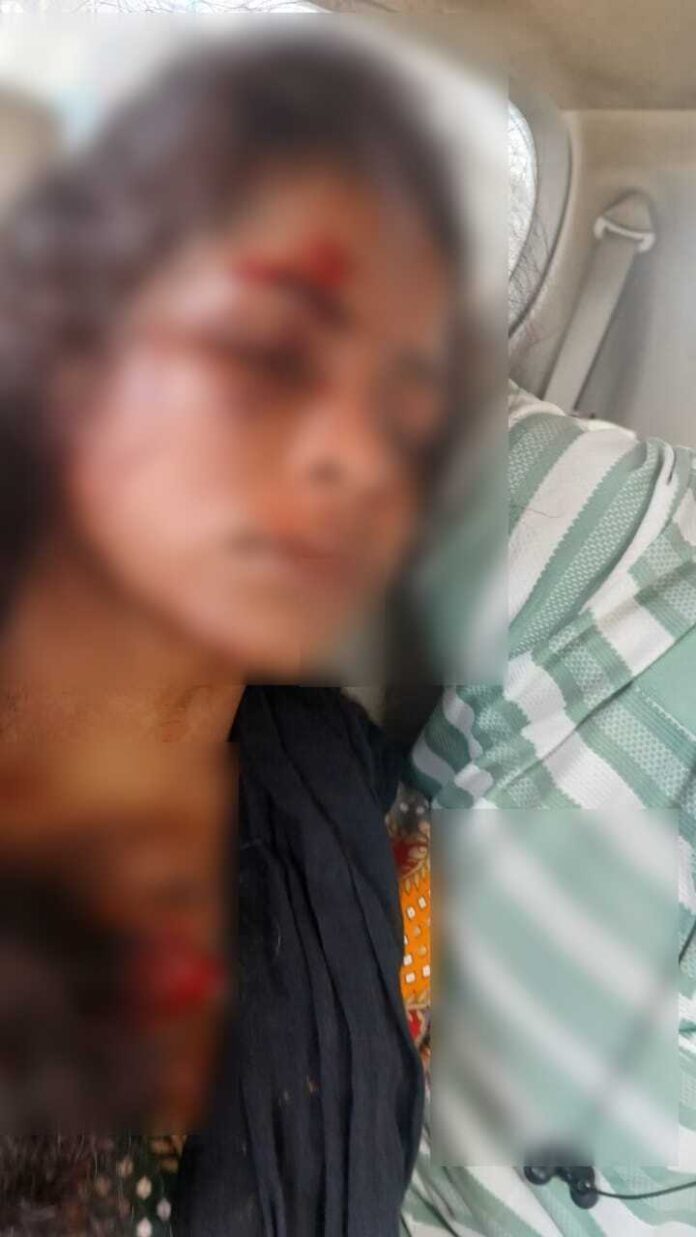 दबंगों का कहर: युवती को पीटा,पुलिस की कार्रवाई पर उठे सवाल