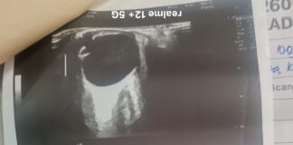 आयुष्मान योजना पर दाग! KGMU में मरीजों के साथ लापरवाही