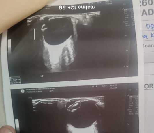 आयुष्मान योजना पर दाग! KGMU में मरीजों के साथ लापरवाही