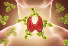 Photo of Thyroid हाइपर और हाइपो थायराइड का घरेलू और सफल उपचार