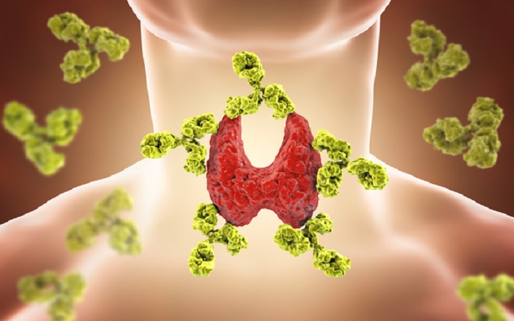 Thyroid हाइपर और हाइपो थायराइड का घरेलू और सफल उपचार