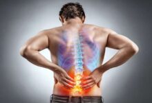 Photo of कमर दर्द (BACK PAIN) का घरेलू उपचार