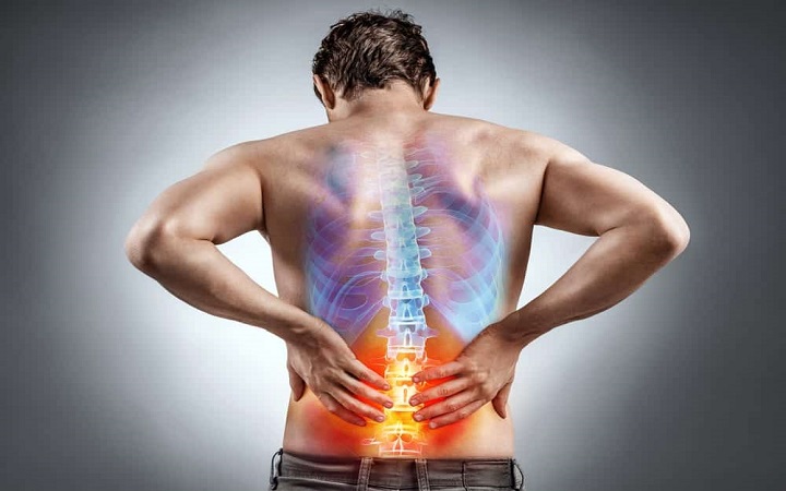 कमर दर्द (BACK PAIN) का घरेलू उपचार